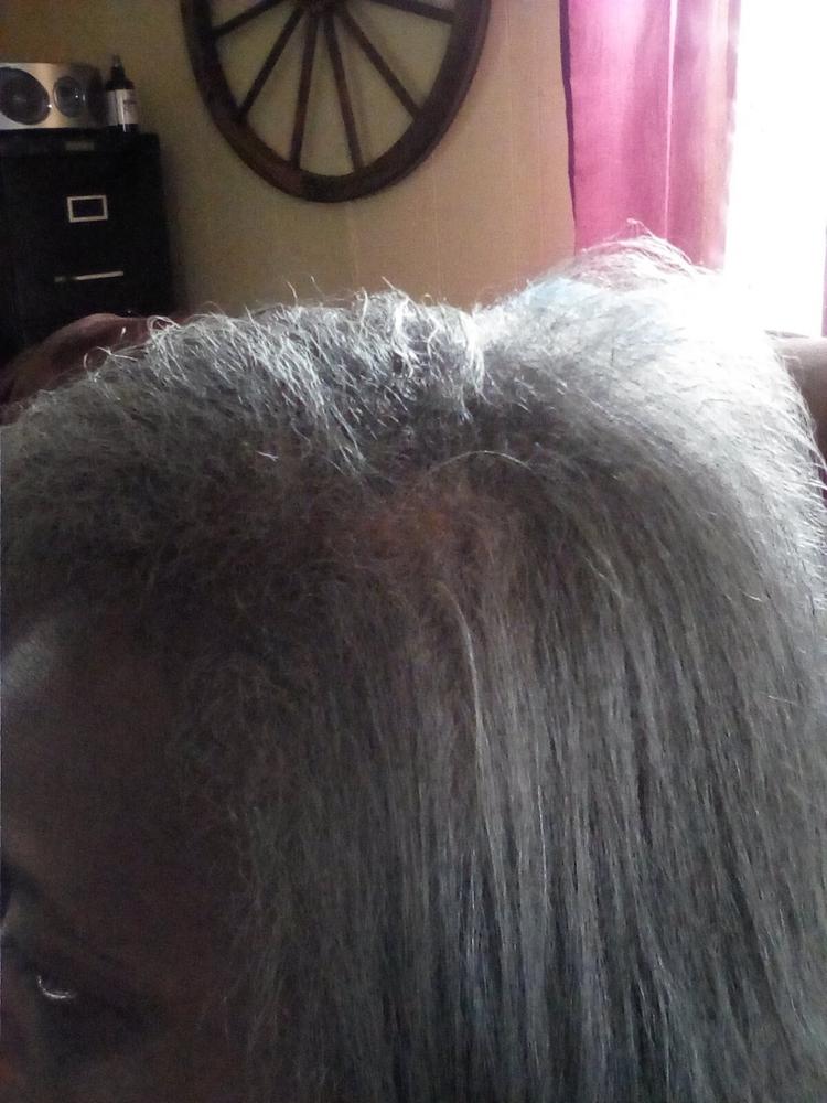 PATENTED HAIR REGROWTH SYSTEM FOR WOMEN - Customer Photo From Jacquelyn Davis