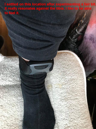 Apollo™ - Customer Photo From Anna Singer