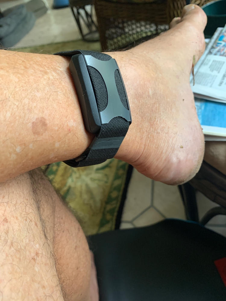 Apollo™ - Customer Photo From Ronald Molyneux