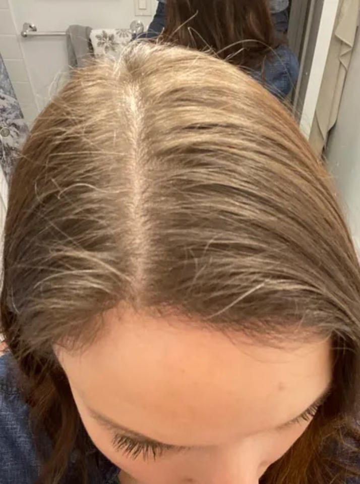 Hair Growth Oil Spray