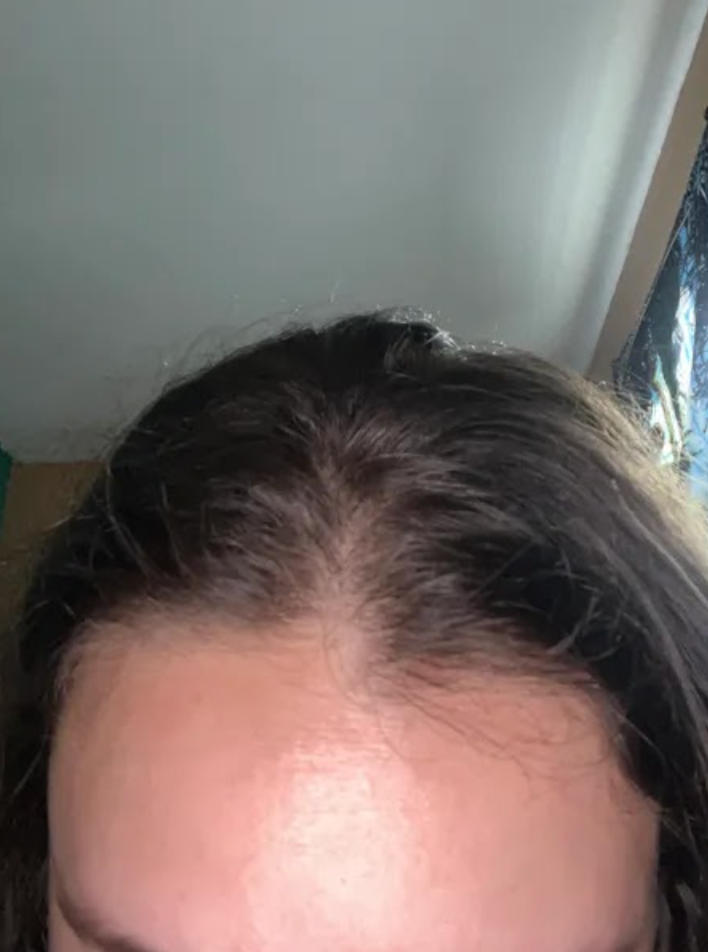 Hair Growth Oil Spray - Customer Photo From Celeste Ju