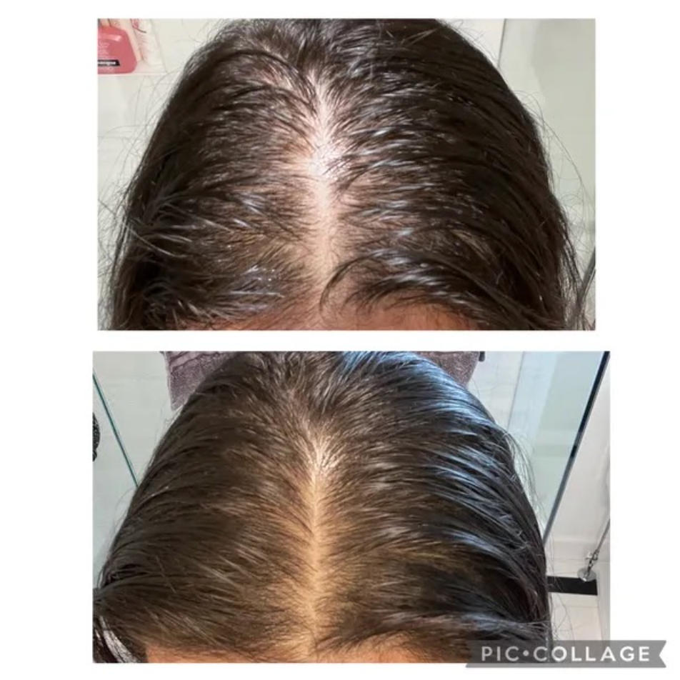 Hair Growth Oil Spray - Customer Photo From Esther T.
