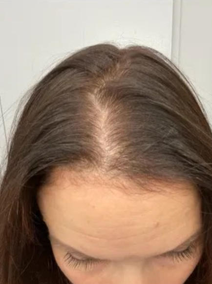Hair Growth Oil Spray