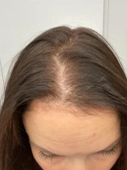 Hair Growth Oil Spray - Customer Photo From Stella C.