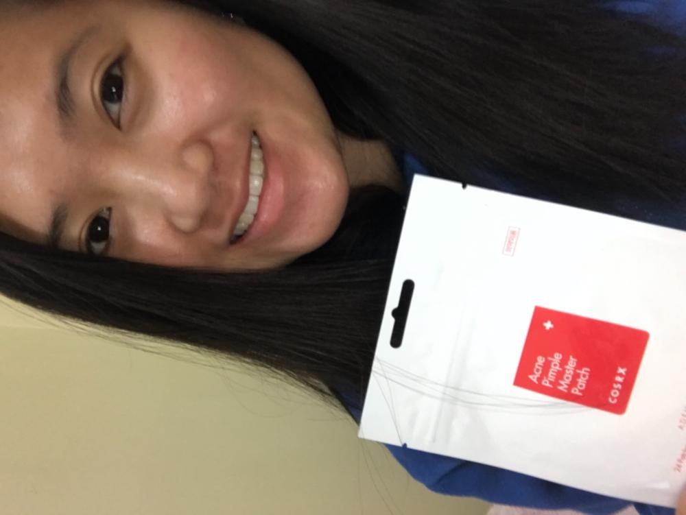 Acne Pimple Master Patch - Customer Photo From Maria M.