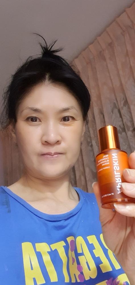 [BOGO] Real Carrotene Blemish Clear Serum - Customer Photo From Irene Chua