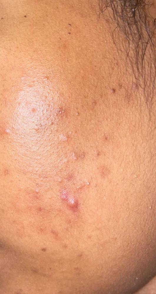 double cleansing - Customer Photo From Laa