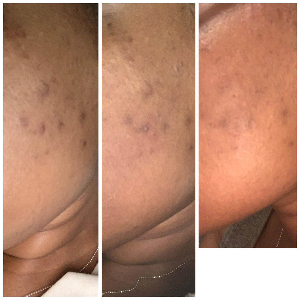 double cleansing - Customer Photo From S1m