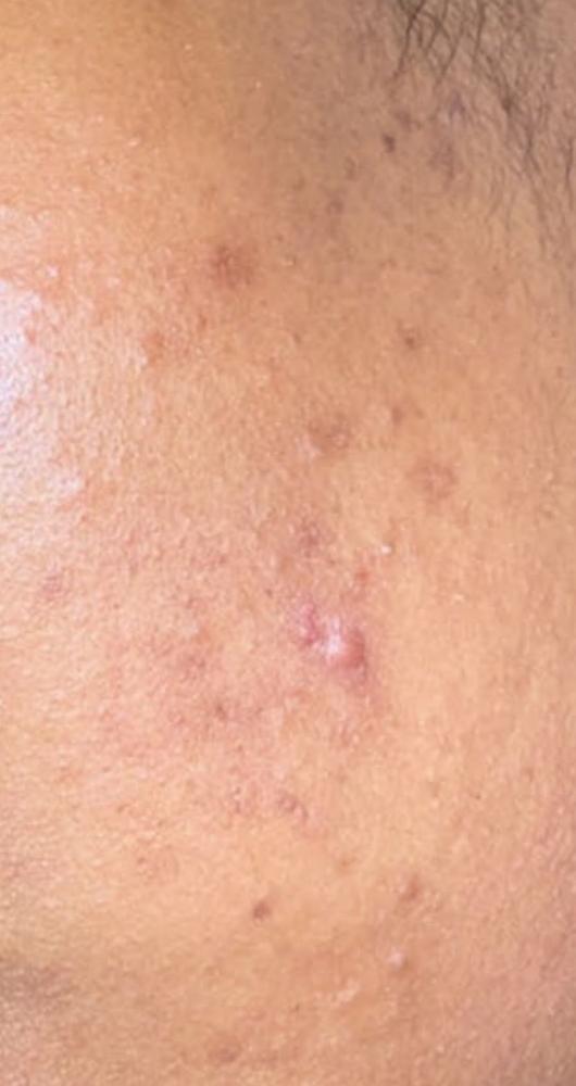 double cleansing - Customer Photo From Laa
