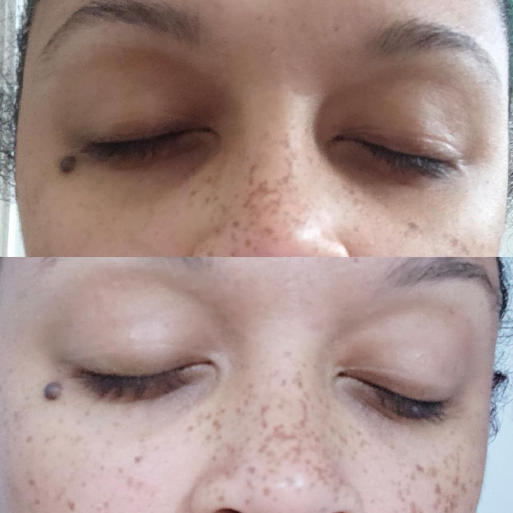 under eye protection - Customer Photo From Esther Bancal