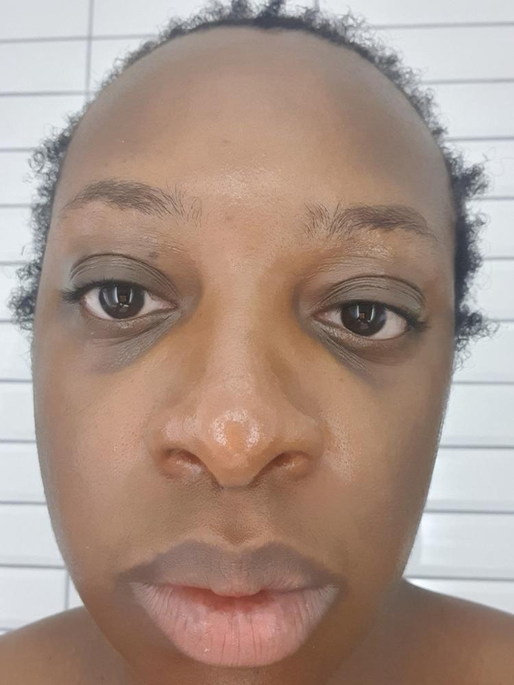 under eye protection - Customer Photo From Simone Wisdom