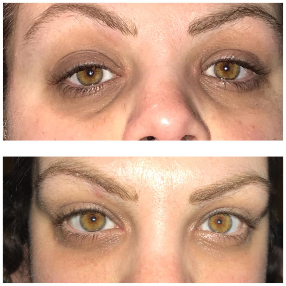 under eye protection - Customer Photo From Jessie Hogan