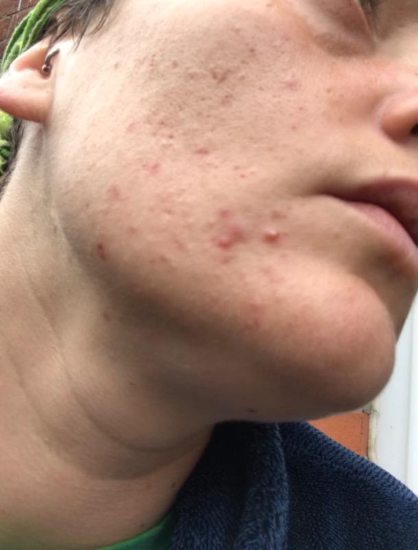 face scrub - Customer Photo From Amy Swan