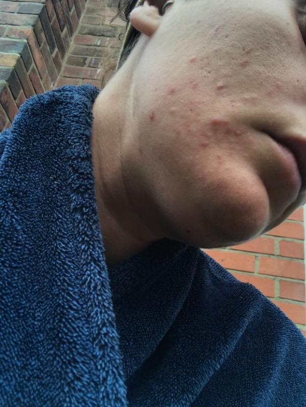 face scrub - Customer Photo From Amy Swan