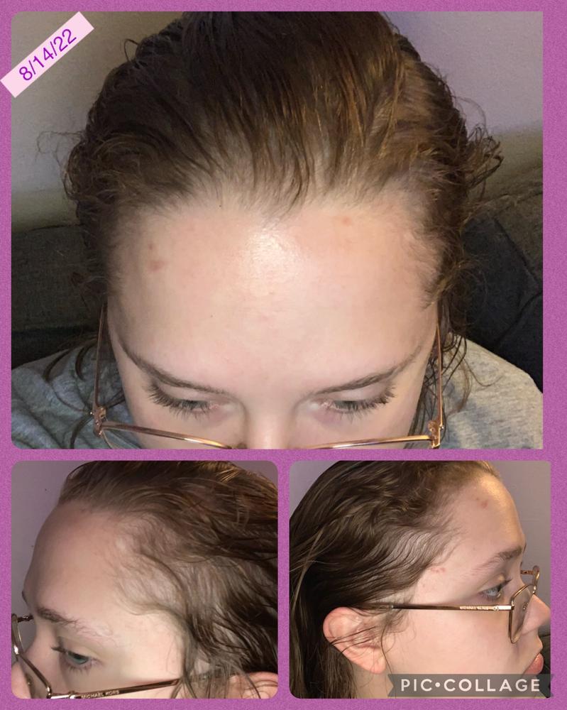 Hair Growth Serum - Customer Photo From Jaime W