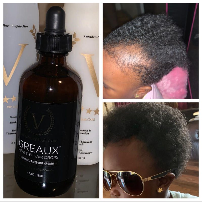 GREAUX Healthy Hair Drops - Customer Photo From Anonymous