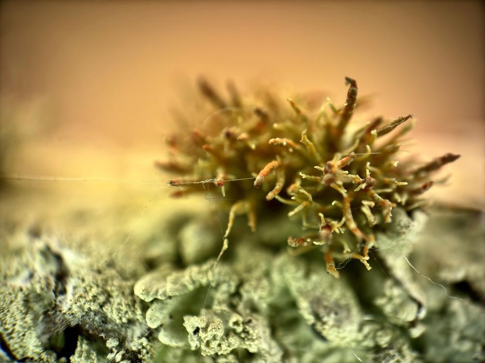 Microscope Lens Edition - iPhone 15 Pro Max - Customer Photo From Anonymous