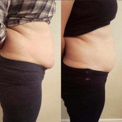 Glambasix Full Body Shaper Glambasix