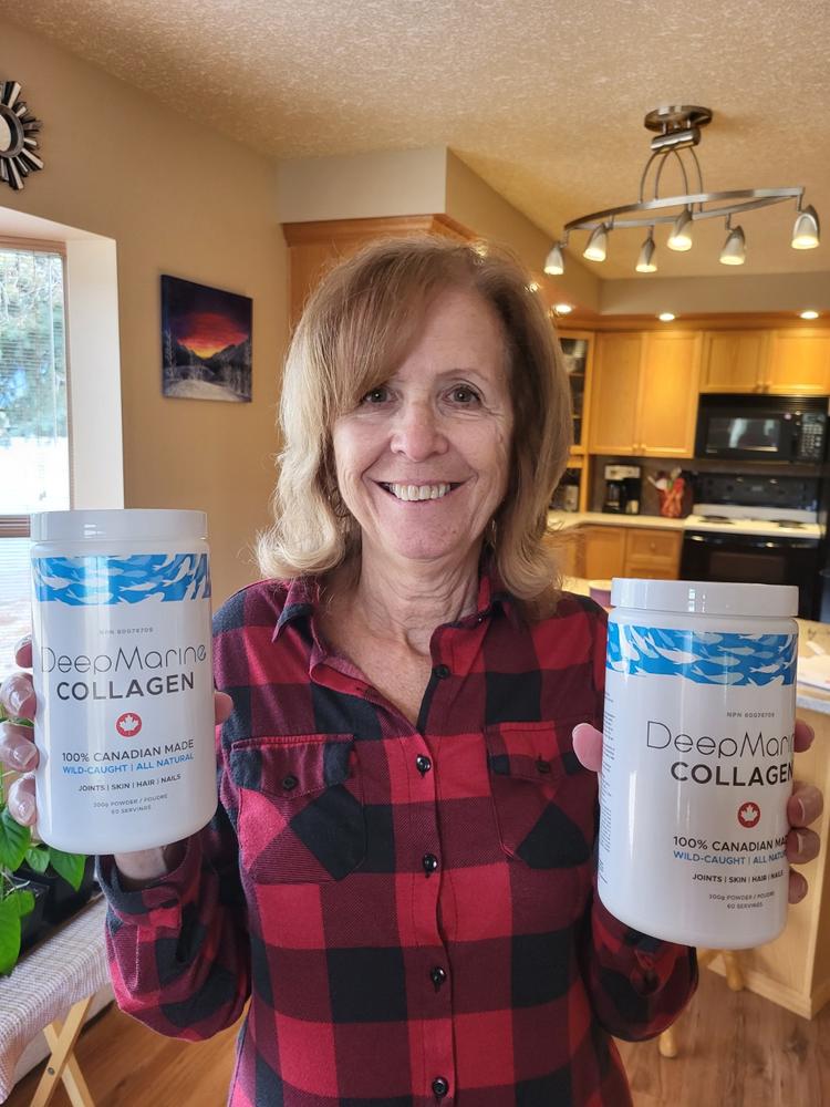 100% Pure, Canadian-Made Marine Collagen Peptides – 120 Day Supply - Customer Photo From Vera Stark