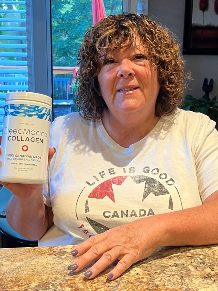 100% Pure, Canadian-Made Marine Collagen Peptides – 120 Day Supply - Customer Photo From Helen Brown