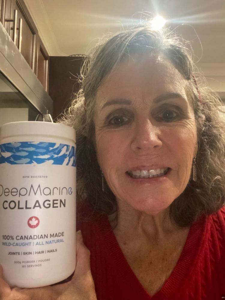 100% Pure, Canadian-Made Marine Collagen Peptides – 60 Day Supply - Customer Photo From Mary and Michael Bailey