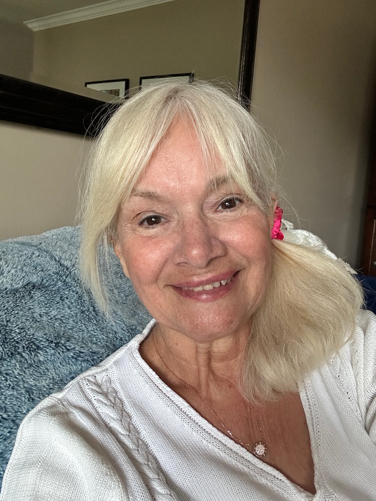 PrimeSkin Magic Repair Serum - Customer Photo From Frances