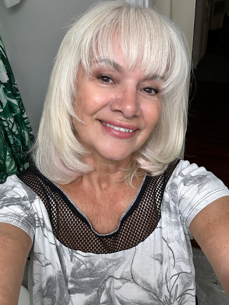 PrimeSkin Magic Repair Serum - Customer Photo From Frances