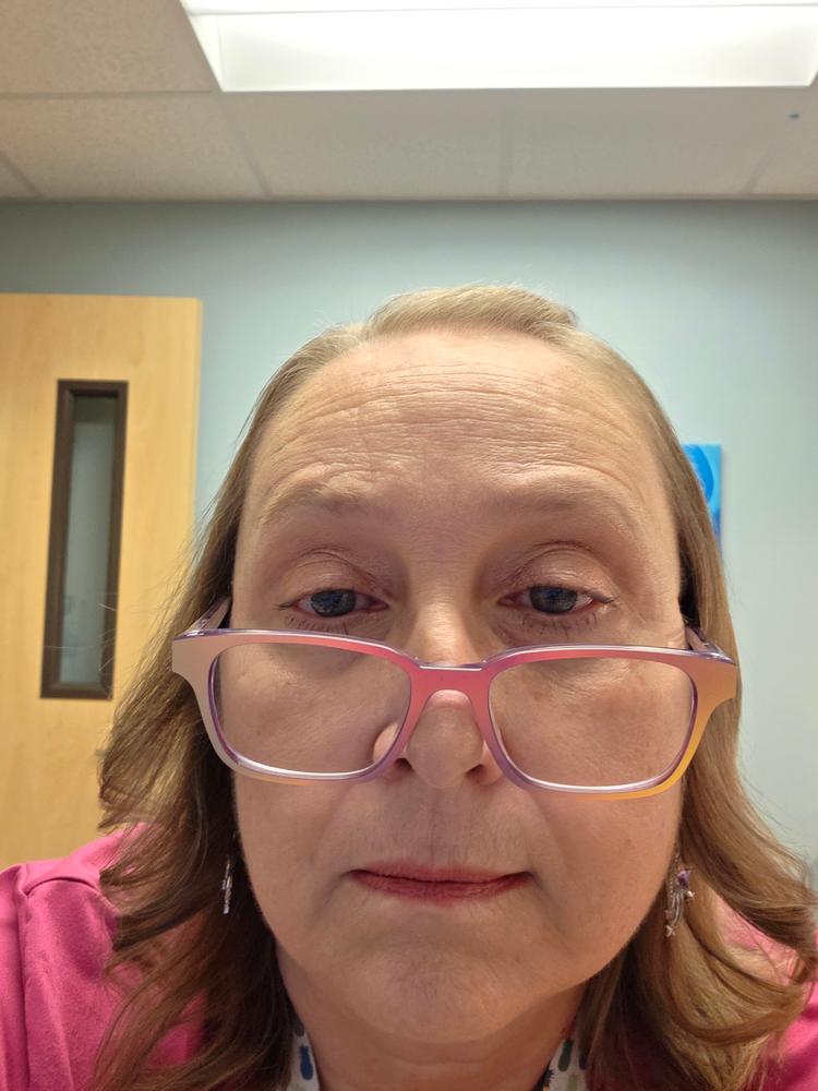 PrimeEyes Eye Brightener - Customer Photo From Yamie