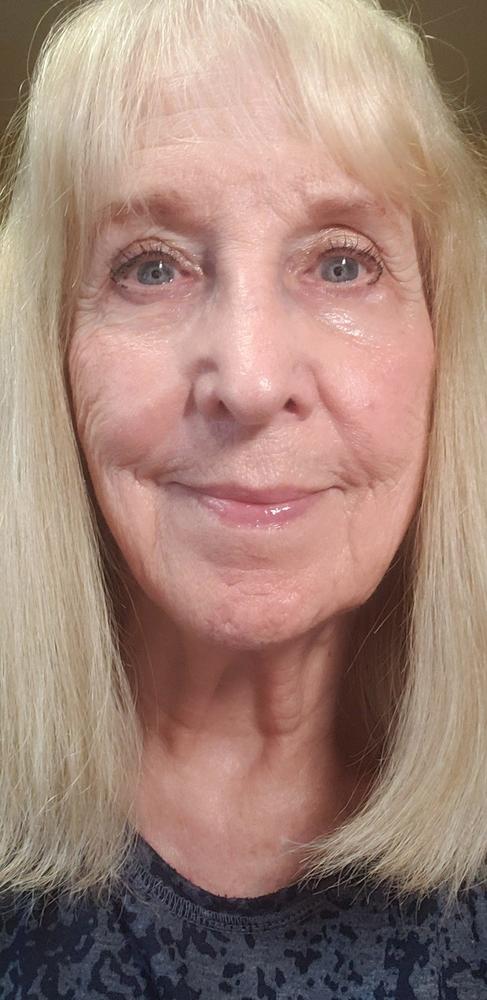 PrimeEyes Eye Brightener - Customer Photo From Lynn Petz