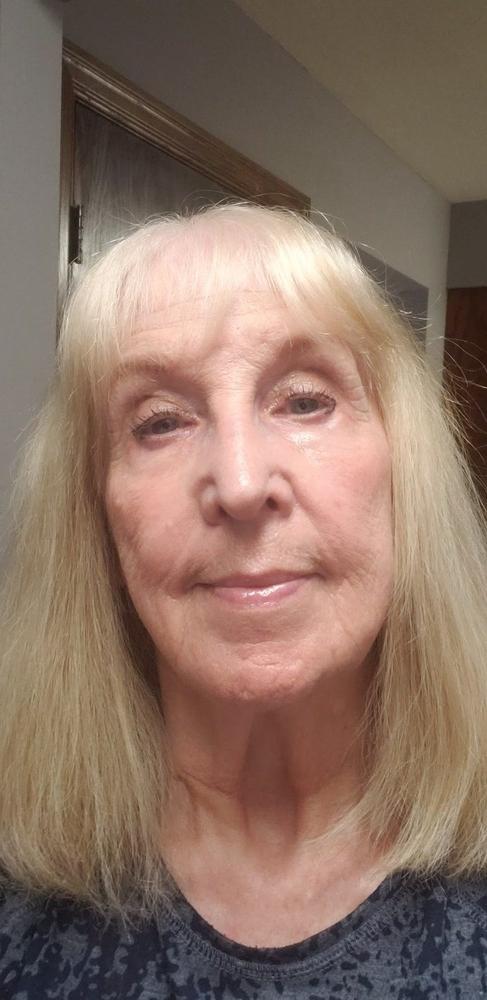 PrimeEyes Eye Brightener - Customer Photo From Lynn Petz