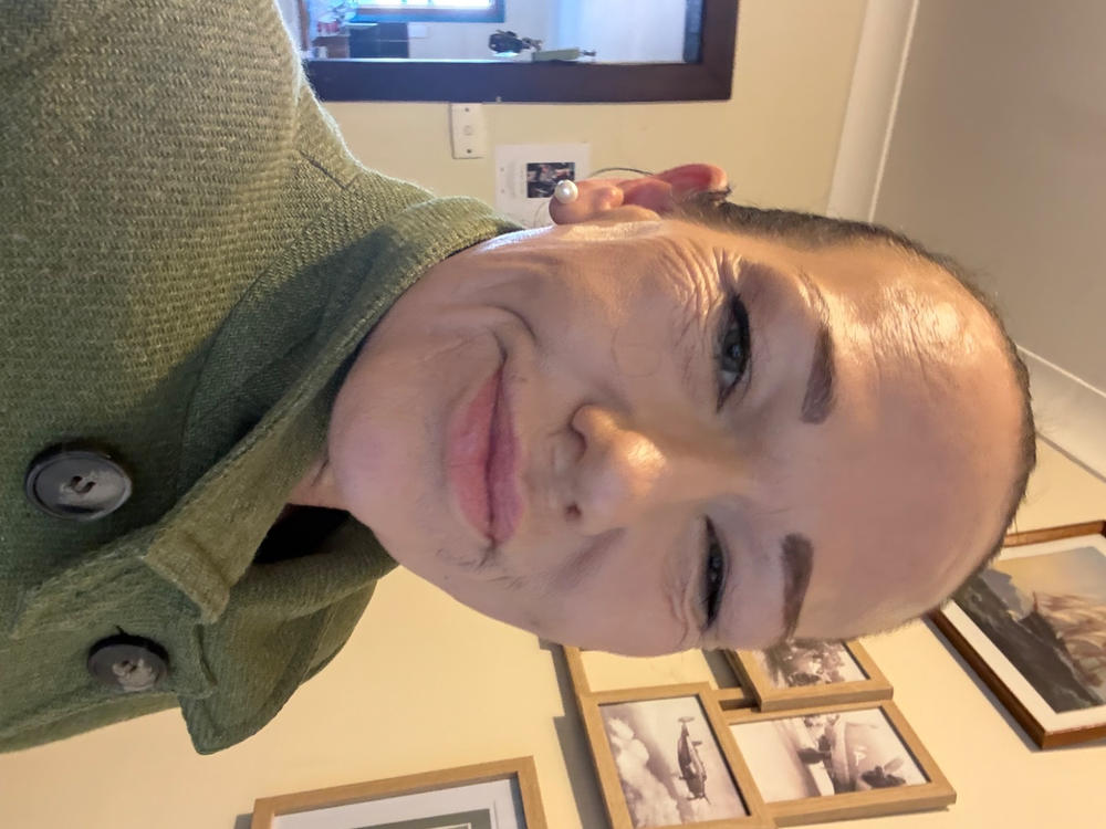 PrimeSkin CC+ Cream - Customer Photo From Amanda Metcalf