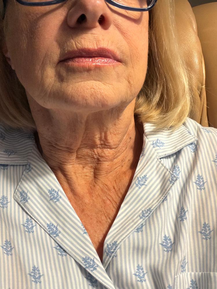 PrimeLip Plumping Lip Balm - Customer Photo From Sue