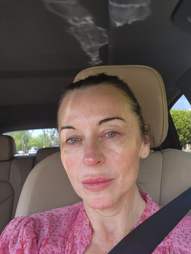 varinha de cuidados com a pele de renovação radiante 4 em 1 e kit de soro ativador - foto do cliente de Giovanna Rosenfeld