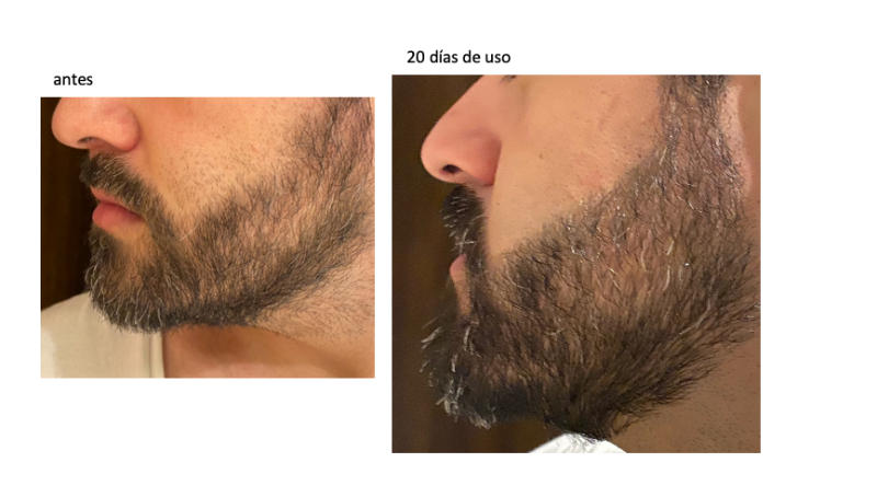 Spectral.BRD® | Serum estimulante para la barba - Customer Photo From Miguel Díaz