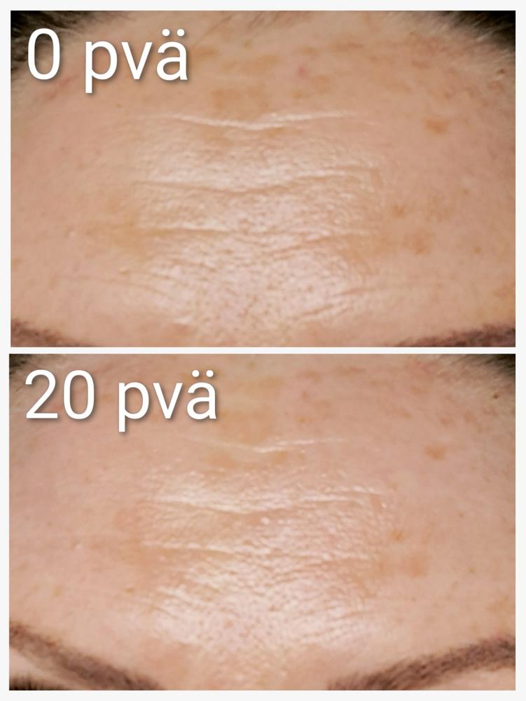 Rakkohauru superseerumi, kiinteyttävä, tasoittava ja kirkastava seerumi aikuiselle iholle, sopii myös atooppiselle, ruusufinnille, epäpuhtaalle iholle, UNISEX, 30 ml - Customer Photo From Anu Terho