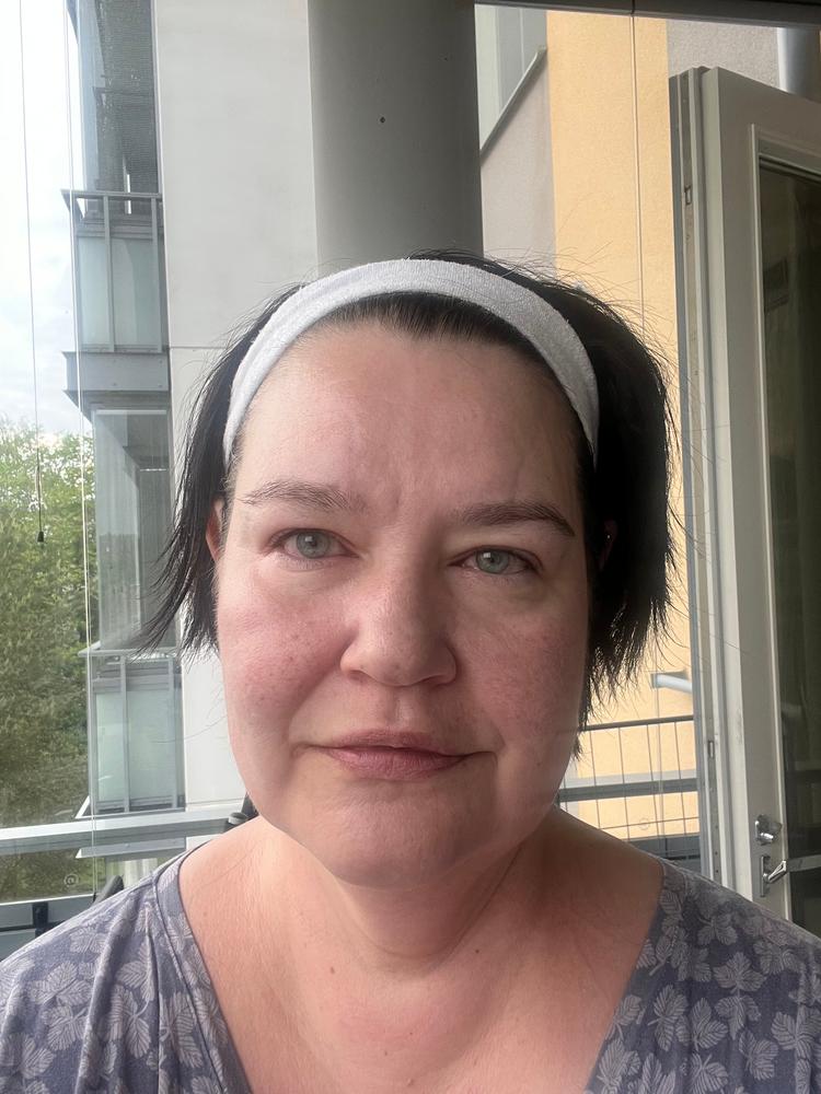 Rakkohauru Superseerumi, kiinteyttävä, tasoittava ja kirkastava seerumi aikuiselle iholle, sopii myös atooppiselle, ruusufinnille, epäpuhtaalle iholle, 30 ml - Customer Photo From Mervi H.