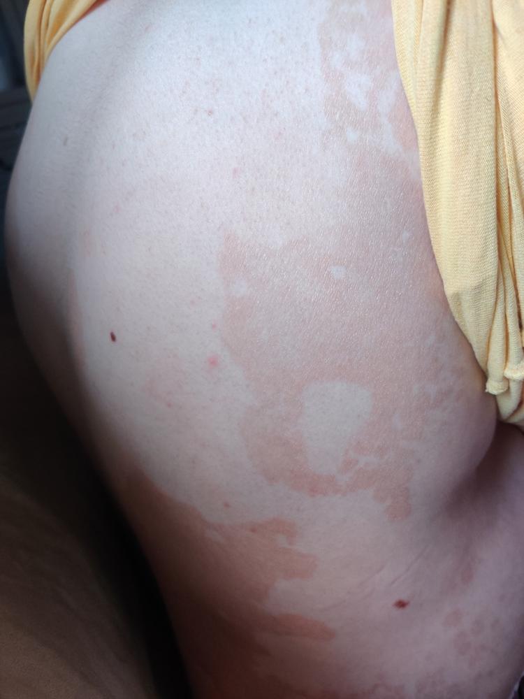 Kesän hehku vartaloöljy, jumalaisen tuoksuinen, nopeasti imeytyvä kuivaöljy vartalolle, 100% luonnollinen,vegaaninen, 50ml - Customer Photo From Vuokko S.