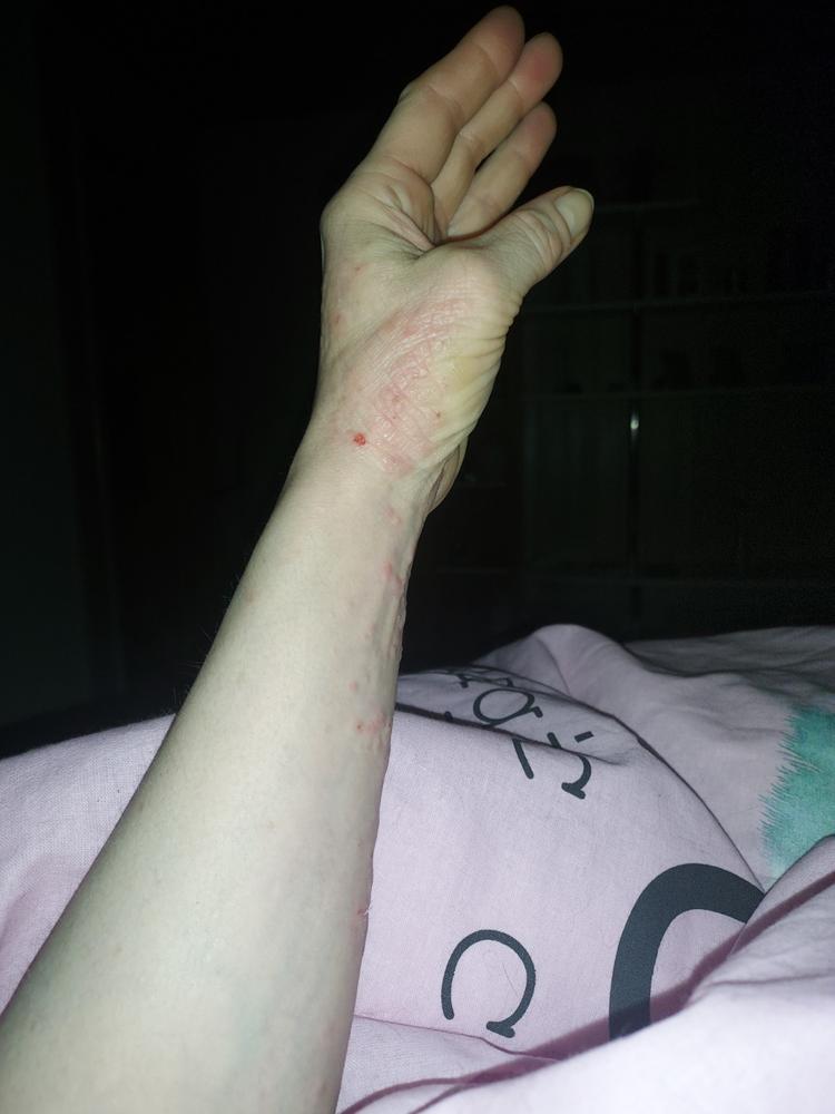 Kamomilla Sheavoide, kutinaa hillitsevä, 100% luonnollinen, 80ml - Customer Photo From Essi T.