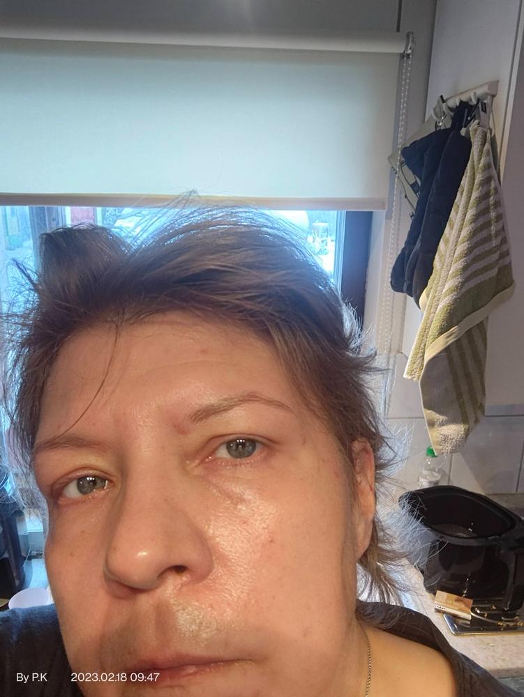 Veera Suolasaippua®, sopii mm. atooppiselle iholle, kutiavalle iholle, akneiholle, 100% luonnollinen, vegaaninen - Customer Photo From Pirjo K.