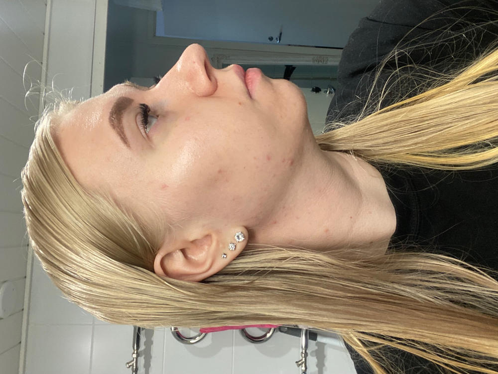 Aloe Vera 24H Kosteuttaja UUSI RESEPTI Prebioottinen Rakkohauru 24H kasvovoide, keramideja sisältävä kosteuttaja,hajusteeton, 50ml - Customer Photo From Olivia Laatunen
