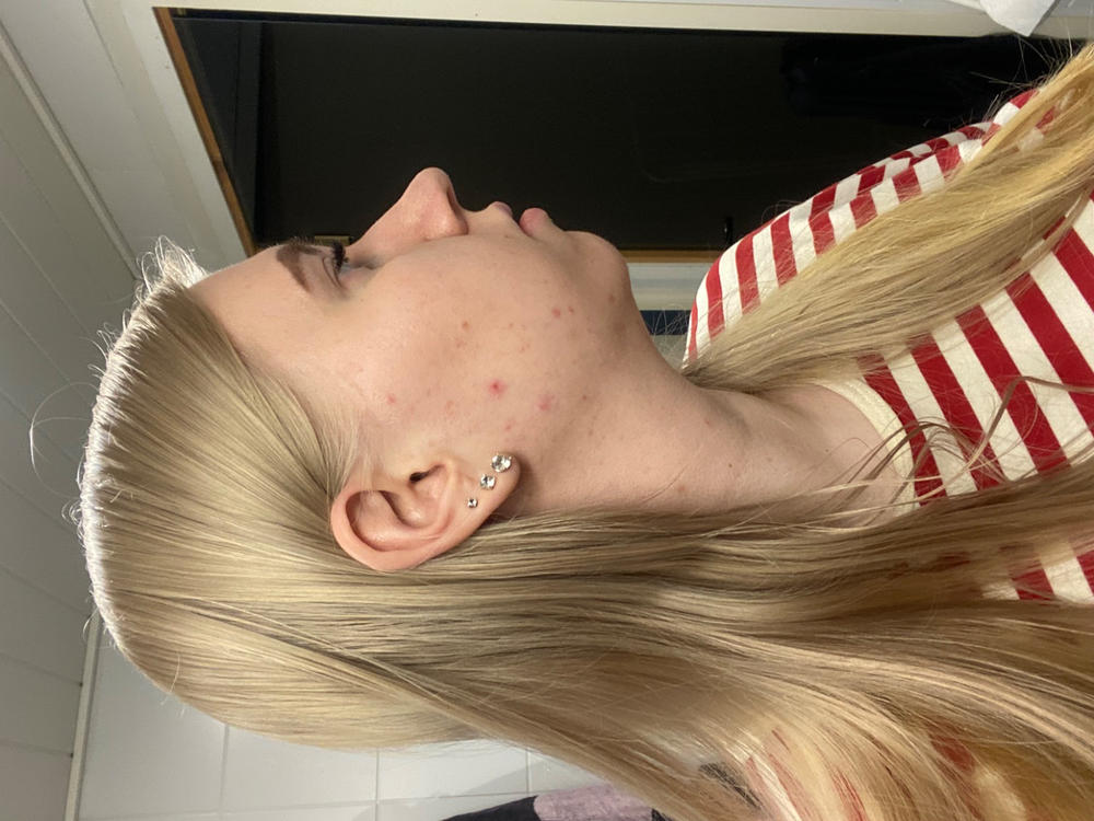 Aloe Vera 24H Kosteuttaja UUSI RESEPTI Prebioottinen Rakkohauru 24H kasvovoide, keramideja sisältävä kosteuttaja,hajusteeton, 50ml - Customer Photo From Olivia Laatunen