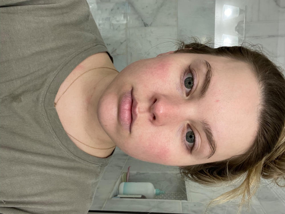 Instant Angel Moisturizer - Customer Photo From Rachel Willis