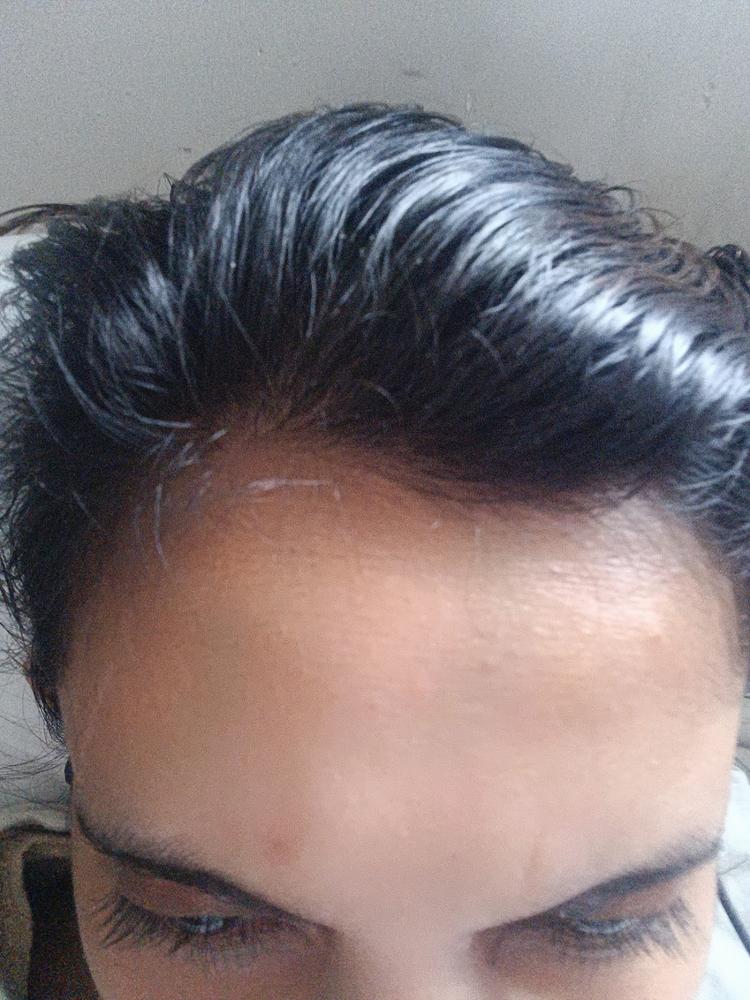 Onion & Bakuchiol Oil Shots For Hair Fall Reduction - Customer Photo From SRI L.