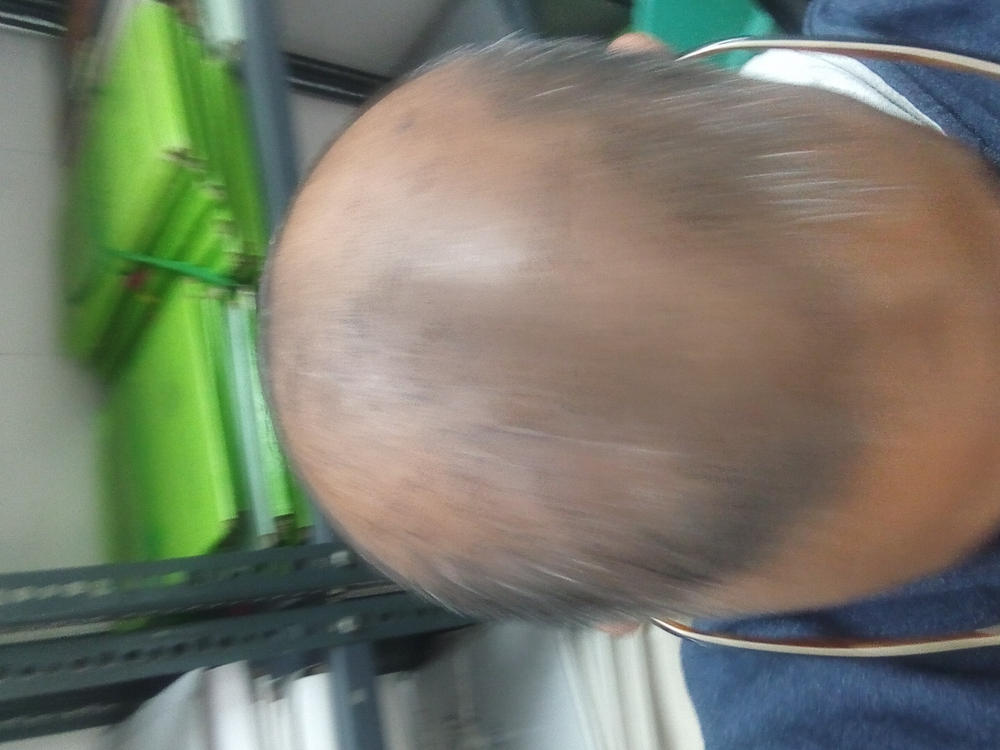 100% Rosemary Essential Oil for Hair Growth - Customer Photo From LAXMI KAJARIA