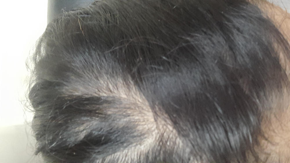 Rosemary Hair Oil with Shampoo for Hair Growth - Customer Photo From Nisha s.