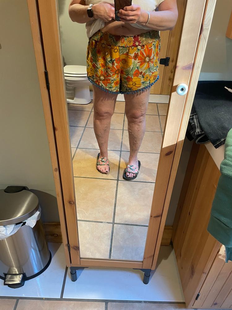 Pom Pom Shorts - Mustard Orange Floral - Customer Photo From Barb
