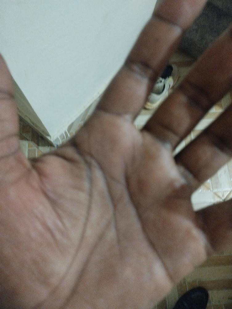 Dermadry Total - Customer Photo From Brian Gatiu