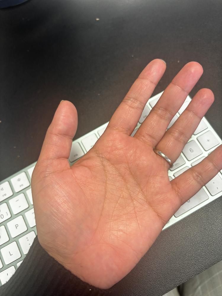 Dermadry Total - Customer Photo From Anna