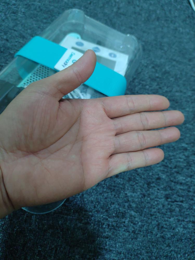 Dermadry Total - For Hands, Feet & Underarms - Customer Photo From Roy Tolledo