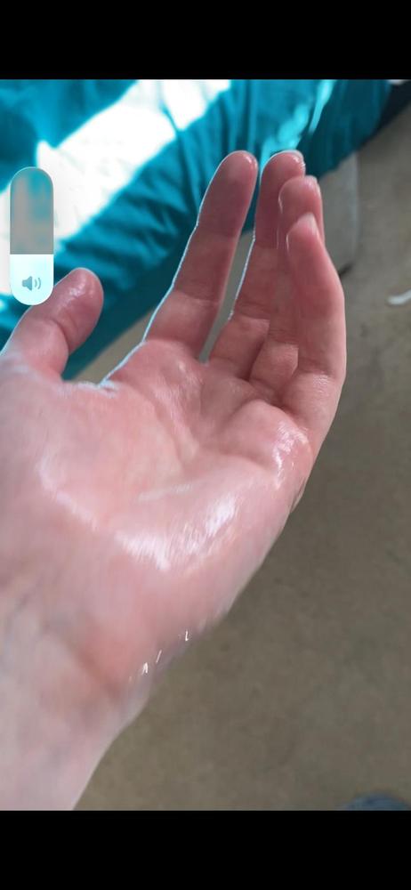 Iontophoresis Machine for Hyperhidrosis | Dermadry Iontophoresis Machine for Hyperhidrosis | Dermadry